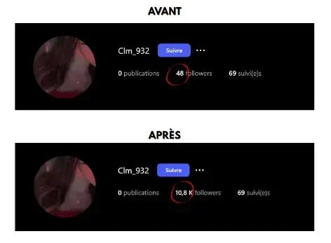 Avant après achat abonnés RetroBoost - Résultats réels